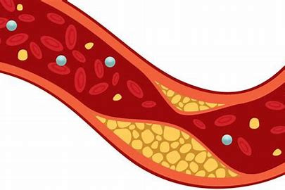 High Density Lipoprotein (HDL)